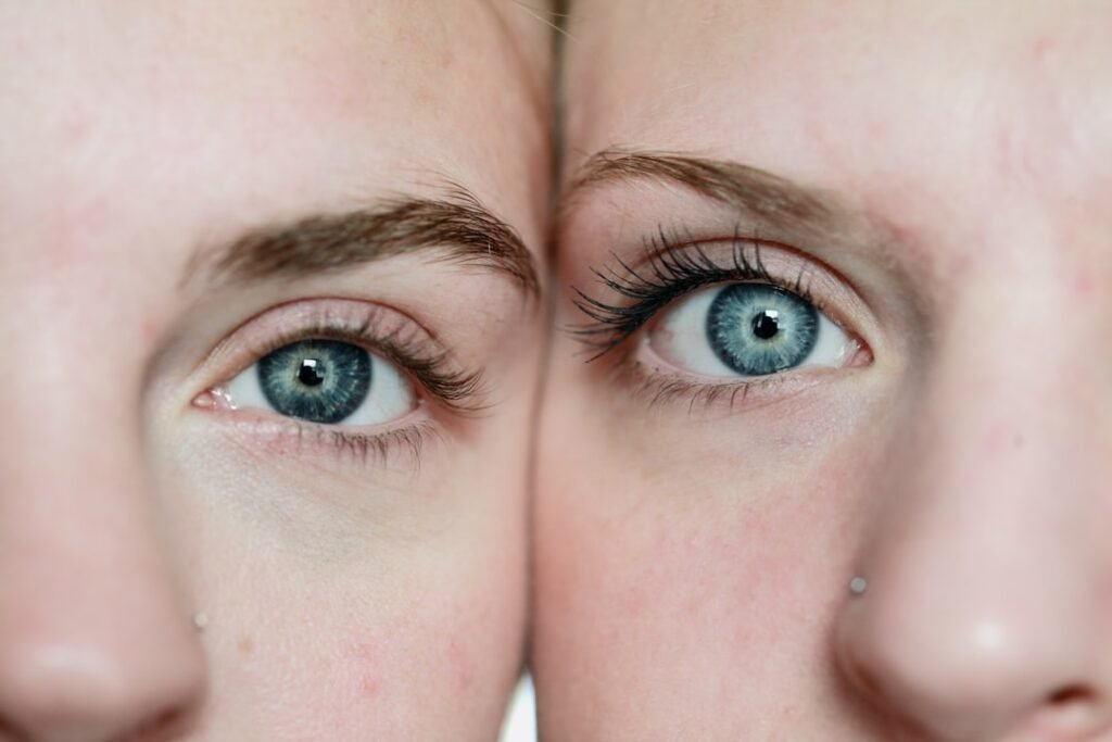 Photo Before/After